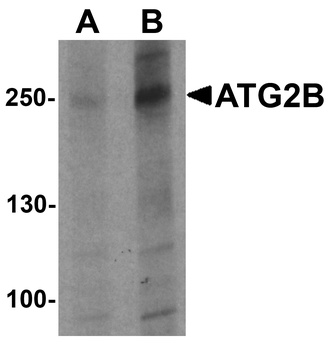 ATG2B Antibody