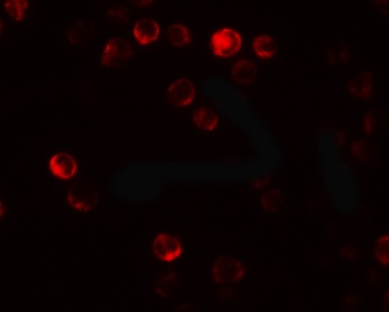ATG2B Antibody