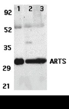 SEPT4 Antibody