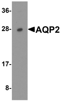 AQP2 Antibody