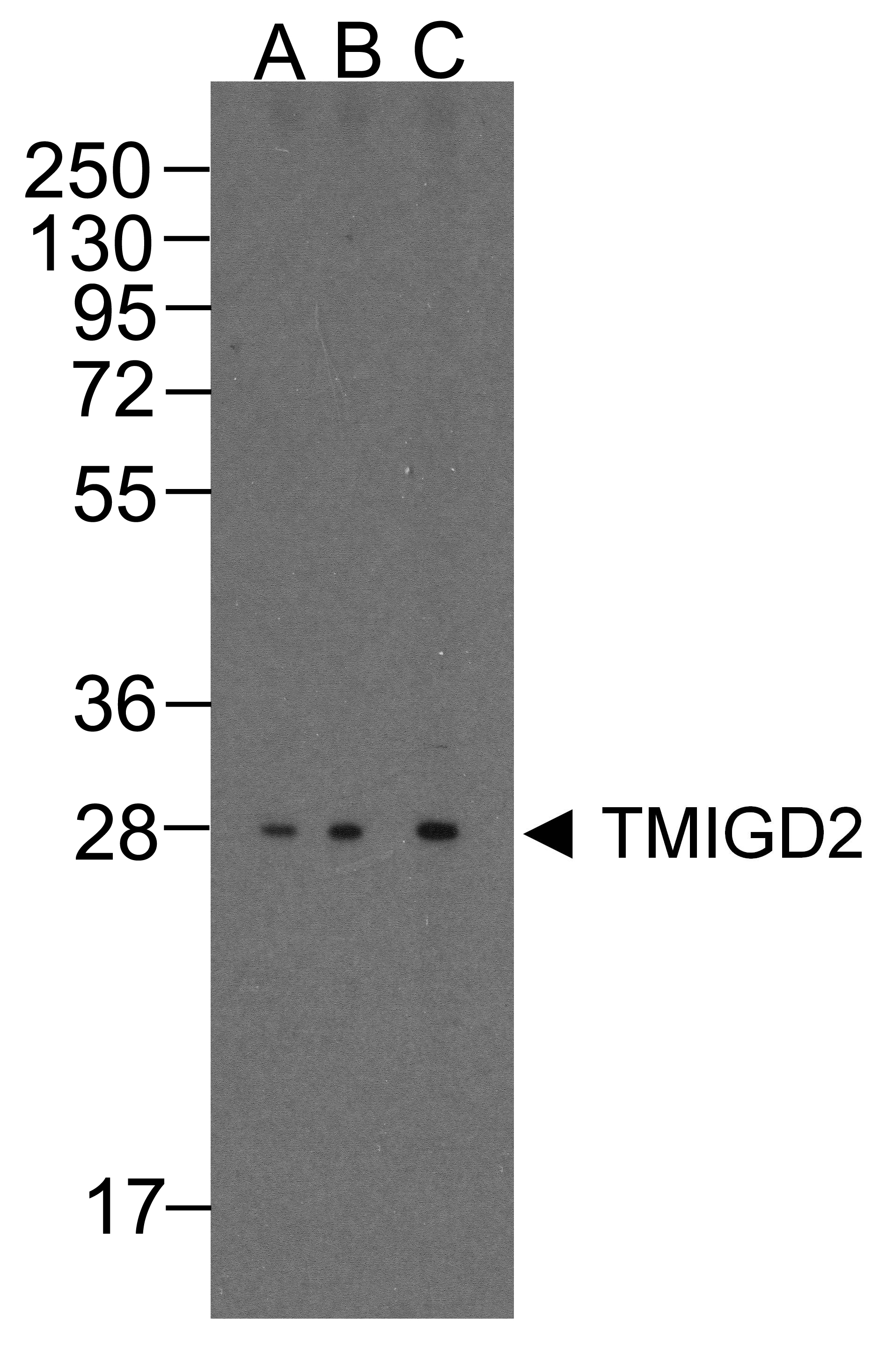 TMIGD2 Antibody