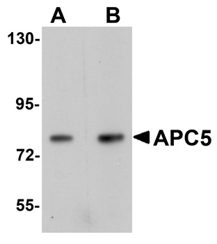 ANAPC5 Antibody
