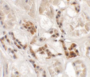 AP3S1 Antibody