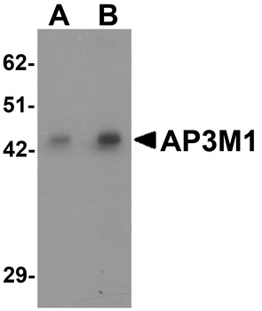 AP3M1 Antibody