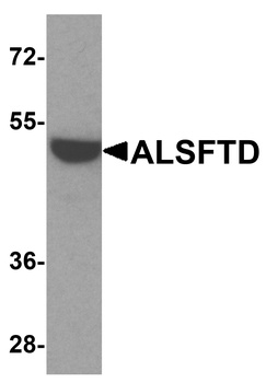 ALSFTD Antibody