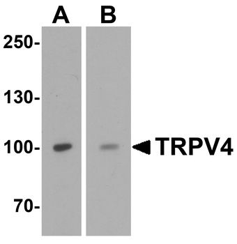 TRPV4 Antibody