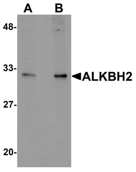 ALKBH2 Antibody