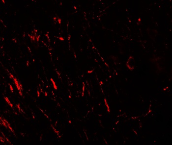 AKT1S1 Antibody