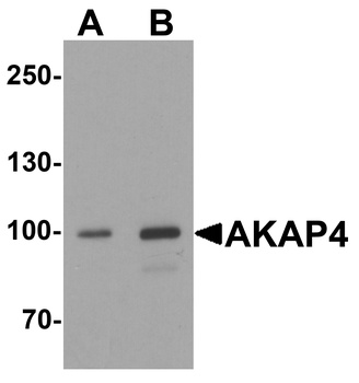 AKAP4 Antibody