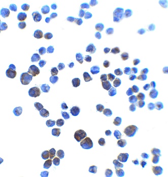 AJAP1 Antibody