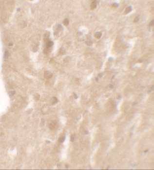 AIMP1 Antibody
