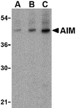 CD5L Antibody