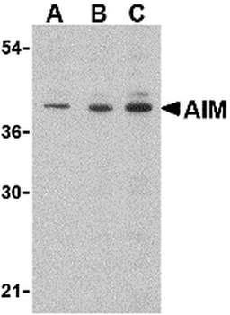 CD5L Antibody