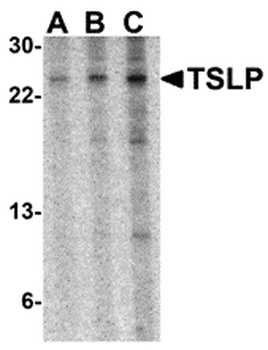 TSLP Antibody