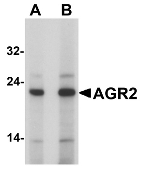 AGR2 Antibody