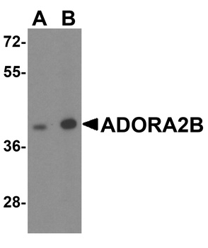 ADORA2B Antibody