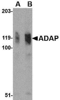 FYB Antibody