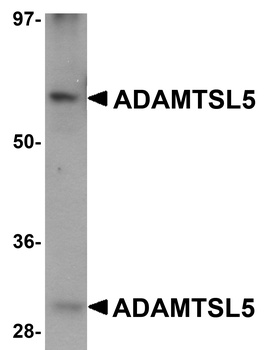 ADAMTSL5 Antibody