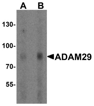 ADAM29 Antibody