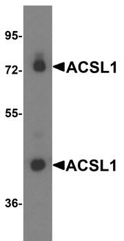 ACSL1 Antibody