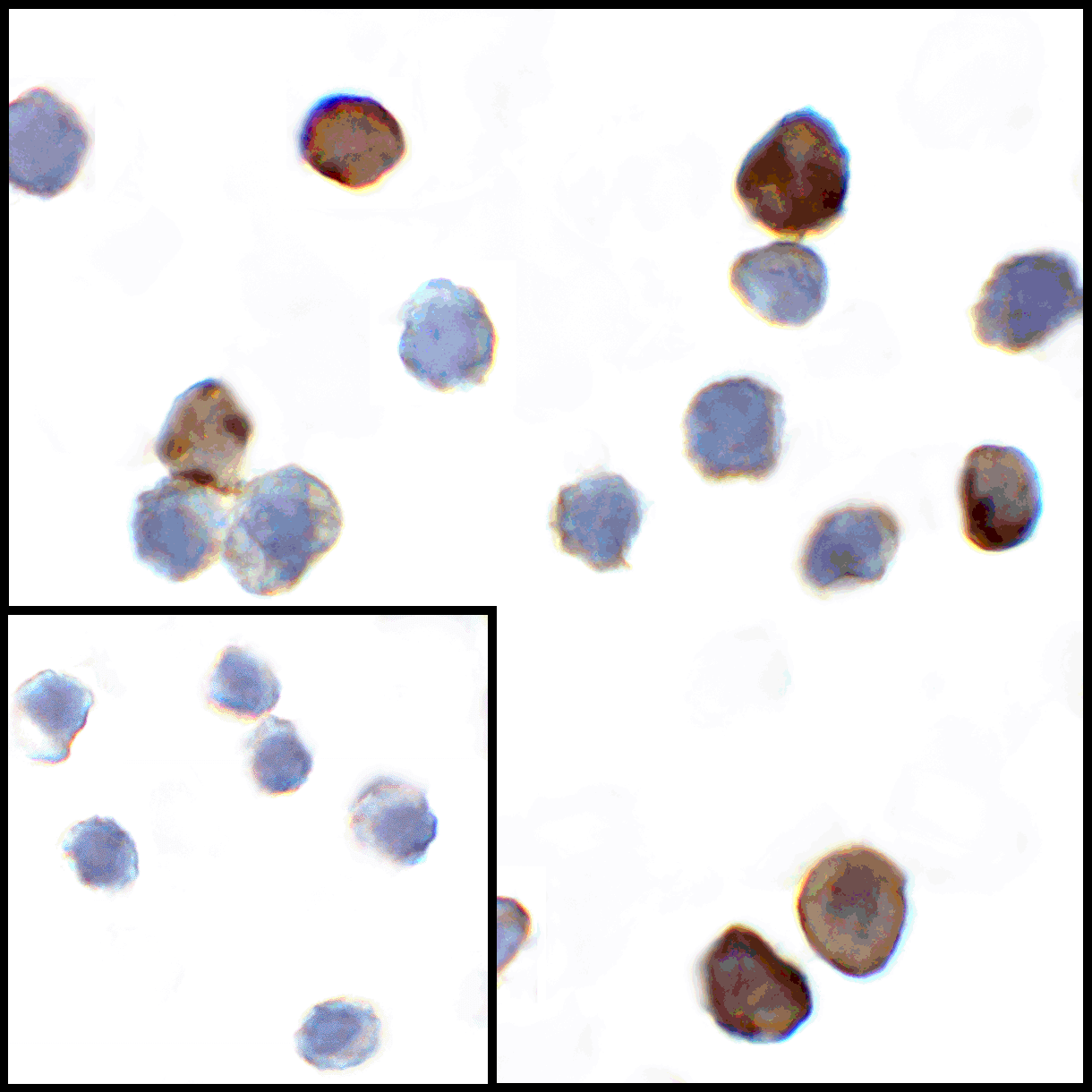 VISTA Antibody [6D2]