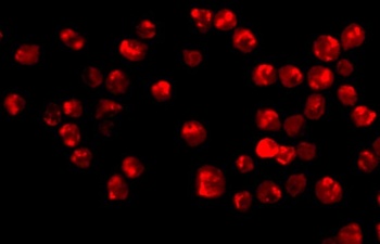 ACIN1 Antibody