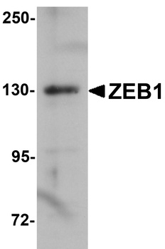 ZEB1 Antibody