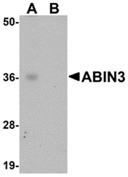 TNIP3 Antibody