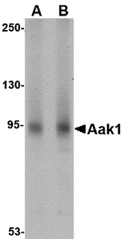 AAK1 Antibody