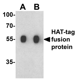 HAT-tag Antibody