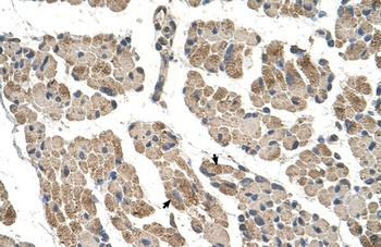 CLCC1 Antibody