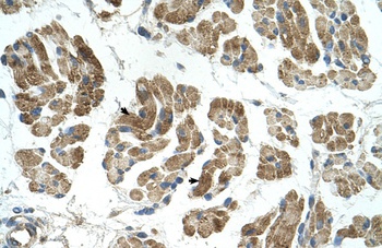 RHOT1 Antibody