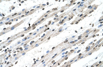 RCE1 Antibody