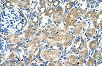 TM9SF1 Antibody