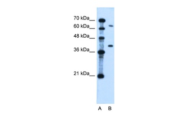 LRRC26 Antibody