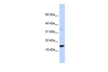 TPD52L3 Antibody