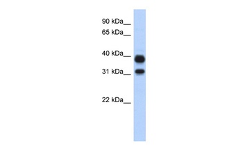 CHIA Antibody