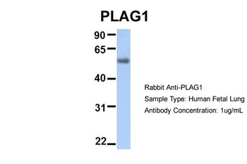 PLAG1 Antibody