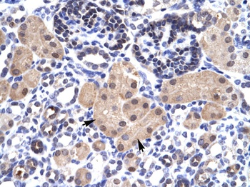 SNAPC2 Antibody