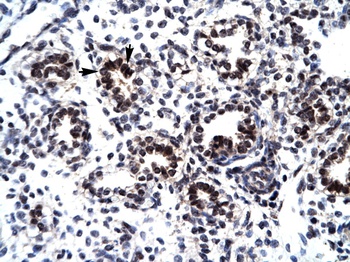 GABPB1 Antibody