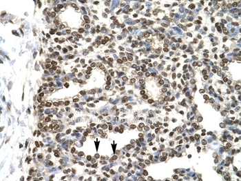 GTF2H2 Antibody