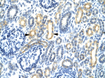 IRF8 Antibody