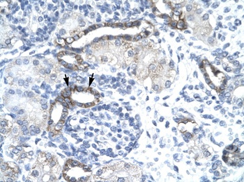 EVX1 Antibody
