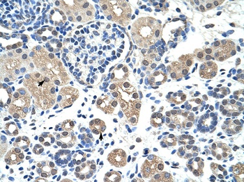 NR2F2 Antibody