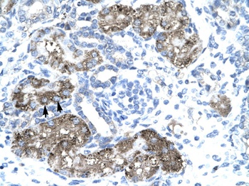 GTF2H1 Antibody