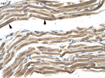 HOXA10 Antibody