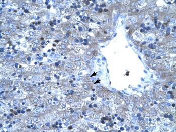 TAL1 Antibody