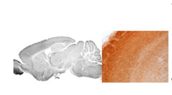 GABRA3 Antibody