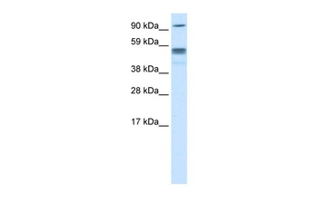SEPT4 (septin-4) Antibody