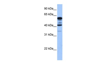 FAM46C Antibody